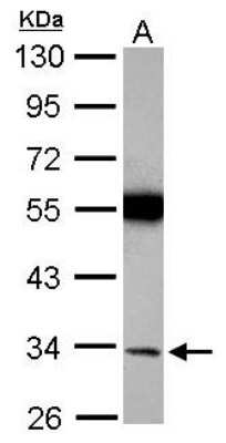 Western Blot: Torsin A Antibody [NBP2-20685]