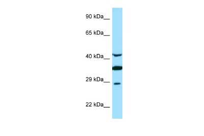 Western Blot: Torsin A Antibody [NBP2-85972]