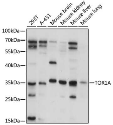 Western Blot: Torsin A AntibodyAzide and BSA Free [NBP2-95160]