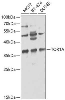 Western Blot: Torsin A AntibodyBSA Free [NBP3-03780]