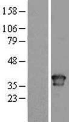 Western Blot: Torsin A Overexpression Lysate [NBL1-17196]