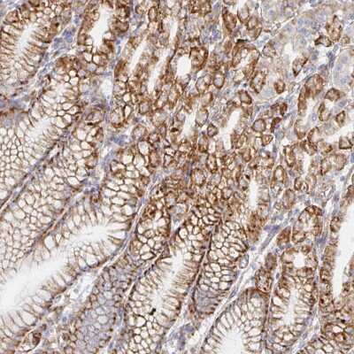 Immunohistochemistry-Paraffin: Trace Amine Receptor 1 Antibody [NBP2-38762]