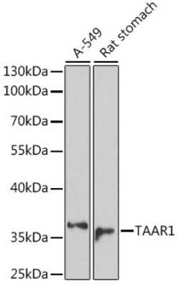 Western Blot: Trace Amine Receptor 1 AntibodyAzide and BSA Free [NBP2-93938]