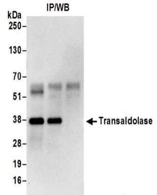 Immunoprecipitation: Transaldolase 1 Antibody [NBP2-32216]