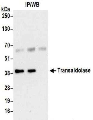 Immunoprecipitation: Transaldolase 1 Antibody [NBP2-32217]