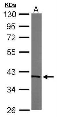 Western Blot: Transaldolase 1 Antibody [NBP1-32121]