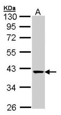 Western Blot: Transaldolase 1 Antibody [NBP1-32121]