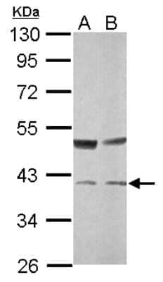 Western Blot: Transaldolase 1 Antibody [NBP2-20695]