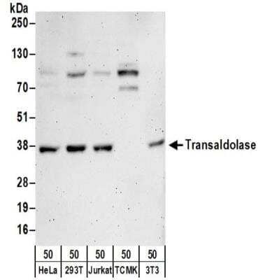 Western Blot: Transaldolase 1 Antibody [NBP2-32216]