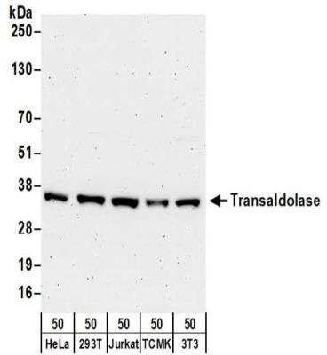 Western Blot: Transaldolase 1 Antibody [NBP2-32217]