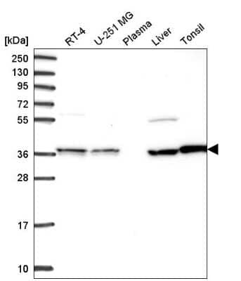 Western Blot: Transaldolase 1 Antibody [NBP2-56305]