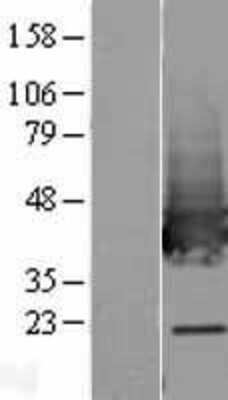 Western Blot: Transaldolase 1 Overexpression Lysate [NBL1-16695]