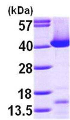 Western Blot: Recombinant Human Transaldolase 1 His Protein [NBP1-45316]