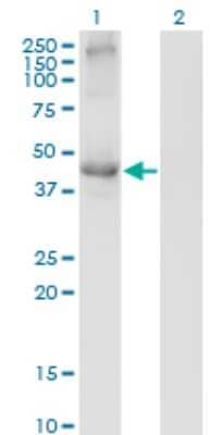 Western Blot: Transcobalamin II Antibody (2F4) [H00006948-M01]