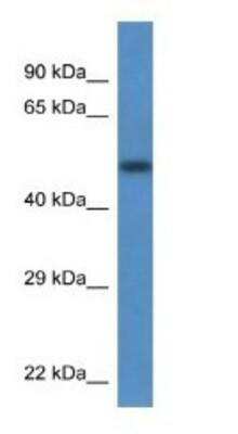 Western Blot: Transcobalamin II Antibody [NBP1-74220]