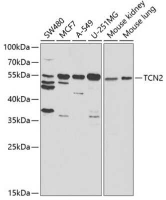 Western Blot: Transcobalamin II AntibodyBSA Free [NBP2-94355]