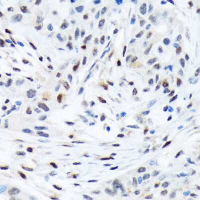 Immunohistochemistry-Paraffin: Transcription factor E3 Antibody (1O9E9) [NBP3-15276]