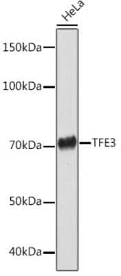Western Blot: Transcription factor E3 Antibody (1O9E9) [NBP3-15276]