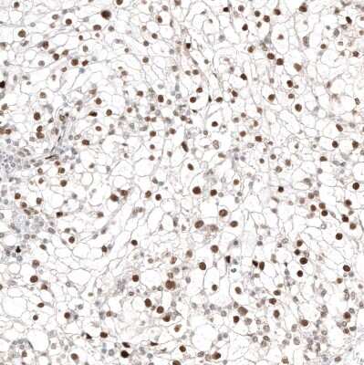 Immunohistochemistry-Paraffin: Transcription factor E3 Antibody (CL12810) [NBP3-18574]