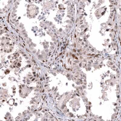 Immunohistochemistry-Paraffin: Transcription factor E3 Antibody (CL12810) [NBP3-18574]