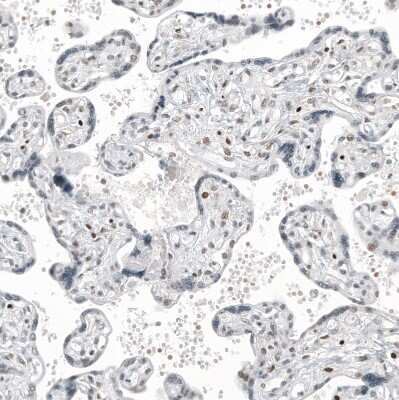Immunohistochemistry-Paraffin: Transcription factor E3 Antibody (CL12810) [NBP3-18574]