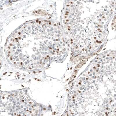 Immunohistochemistry-Paraffin: Transcription factor E3 Antibody (CL12810) [NBP3-18574]