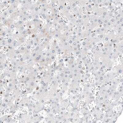 Immunohistochemistry-Paraffin: Transcription factor E3 Antibody (CL12810) [NBP3-18574]