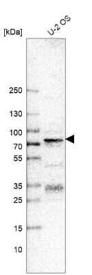 Immunohistochemistry-Paraffin: Transcription factor E3 Antibody (CL12810) [NBP3-18574]