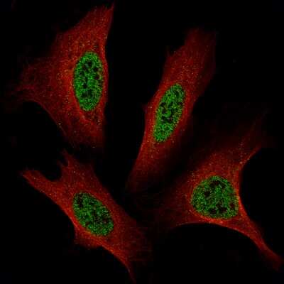 Immunocytochemistry/ Immunofluorescence: Transcription factor E3 Antibody (CL12822) [NBP3-18540]