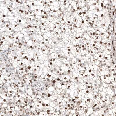 Immunohistochemistry-Paraffin: Transcription factor E3 Antibody (CL12822) [NBP3-18540]