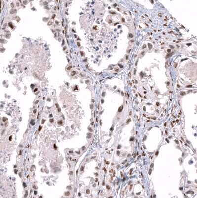 Immunohistochemistry-Paraffin: Transcription factor E3 Antibody (CL12822) [NBP3-18540]