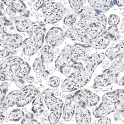 Immunohistochemistry-Paraffin: Transcription factor E3 Antibody (CL12822) [NBP3-18540]