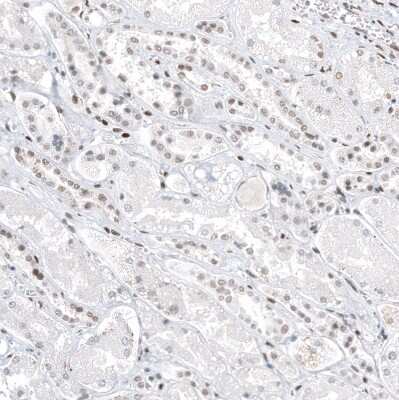 Immunohistochemistry-Paraffin: Transcription factor E3 Antibody (CL12822) [NBP3-18540]
