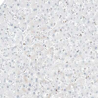 Immunohistochemistry-Paraffin: Transcription factor E3 Antibody (CL12822) [NBP3-18540]