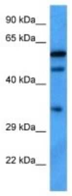 Western Blot: Transcription factor E3 Antibody [NBP3-09959]