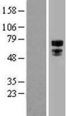 Western Blot: Transcription factor E3 Overexpression Lysate [NBL1-16837]