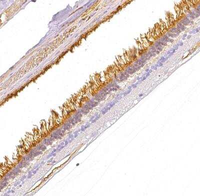 Immunohistochemistry-Paraffin: Transducin alpha Antibody [NBP2-55596]