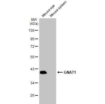 Western Blot: Transducin alpha Antibody [NBP2-20696]