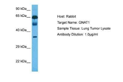 Western Blot: Transducin alpha Antibody [NBP2-88455]