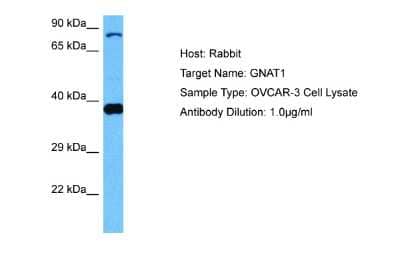 Western Blot: Transducin alpha Antibody [NBP2-88458]