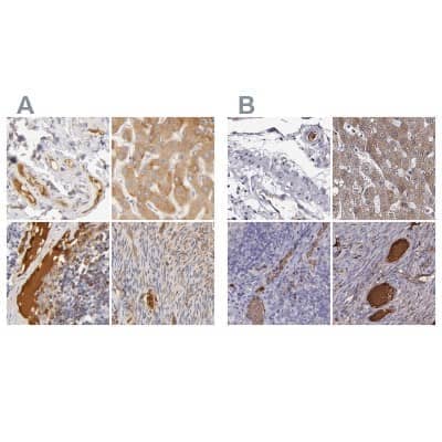 Immunohistochemistry-Paraffin: Transferrin Antibody [NBP1-87222]