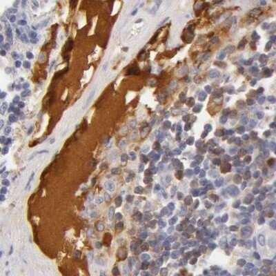 Immunohistochemistry-Paraffin: Transferrin Antibody [NBP1-87222]