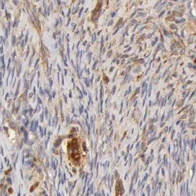 Immunohistochemistry-Paraffin: Transferrin Antibody [NBP1-87222]