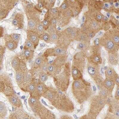 Immunohistochemistry-Paraffin: Transferrin Antibody [NBP1-87222]