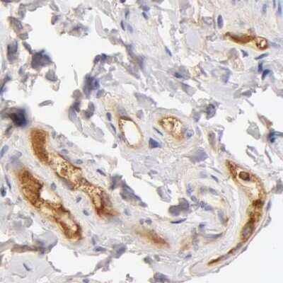 Immunohistochemistry-Paraffin: Transferrin Antibody [NBP1-87222]