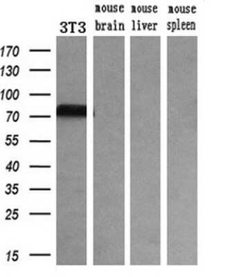 Western Blot: Transferrin Antibody (OTI5G2) [NBP2-02264]