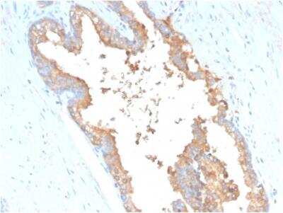 Immunohistochemistry-Paraffin: Transferrin Antibody (TF/3001) - Azide and BSA Free [NBP2-79912]