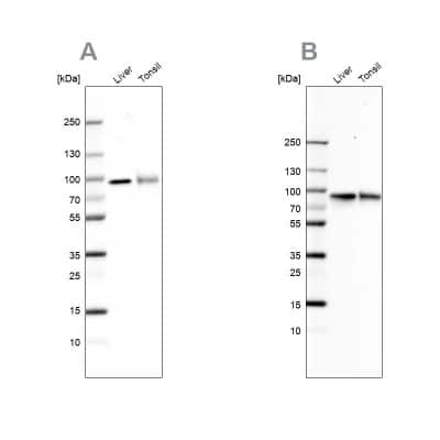 Western Blot: Transferrin Antibody [NBP1-87221]