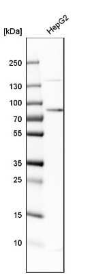 Western Blot: Transferrin Antibody [NBP1-87222]