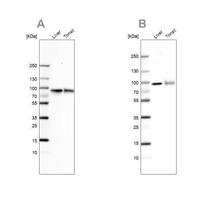 Western Blot: Transferrin Antibody [NBP1-87222]